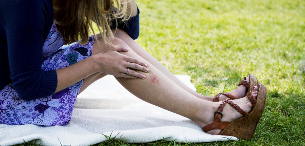 Woman applying ointment