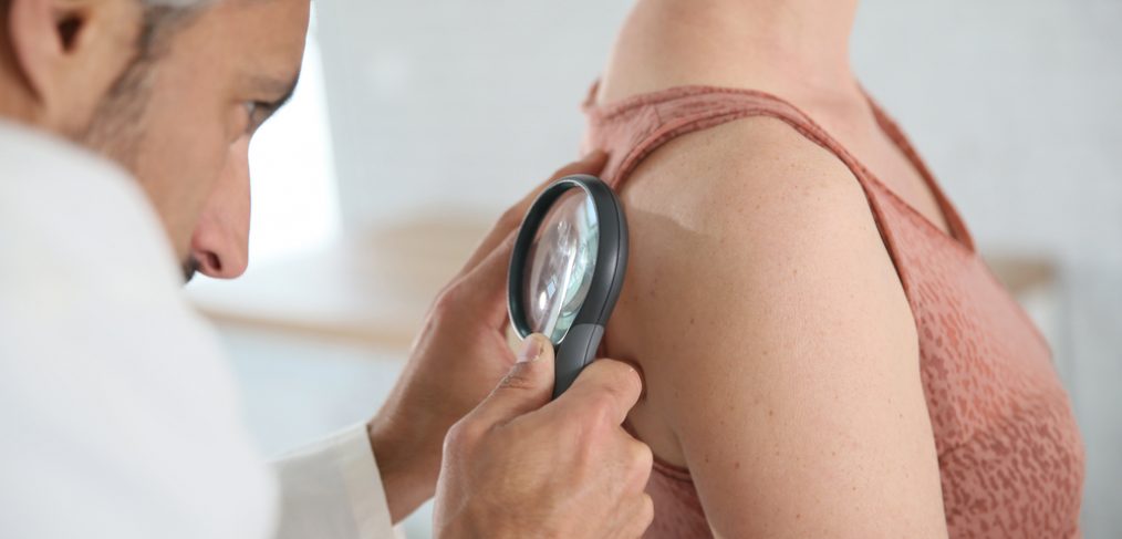 Doctor checking on patient's skin